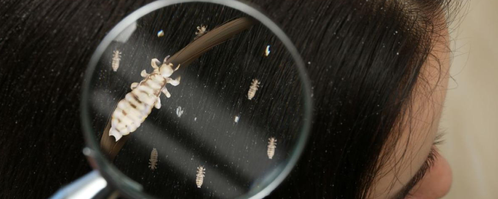 درمان شپش؛ بهترین راه‌های جلوگیری در دانش‌آموزان در مدارس